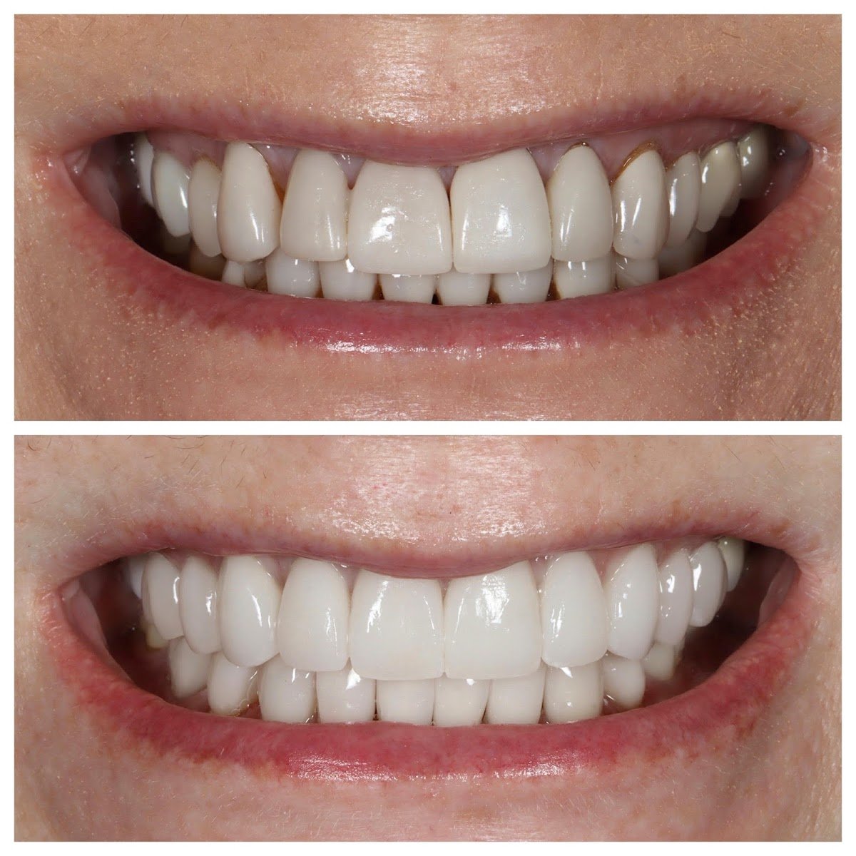 New York Center For Cosmetic Dentistry - Dr. Emanuel Layliev DDS photo 2