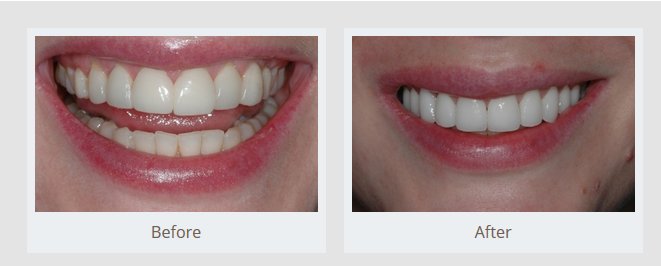 NYC Smile Design: Ramin Tabib, DDS photo 3