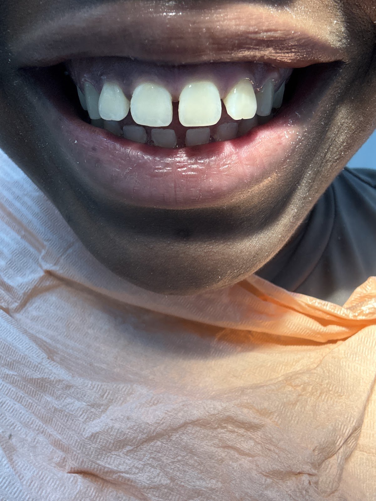 Upper East Side Dentist - Sherwin Benlevi DDS PC photo 4