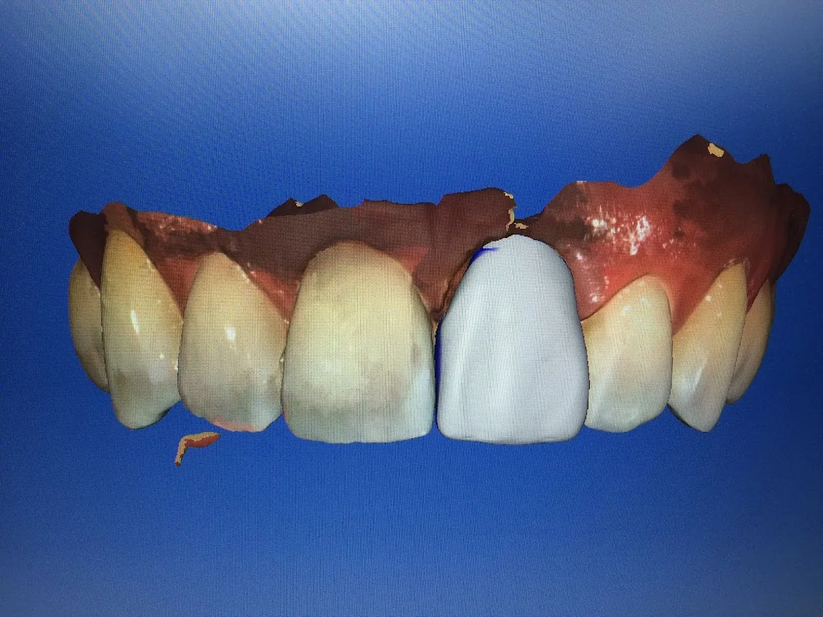 Crown Heights Dental Clinic photo 5