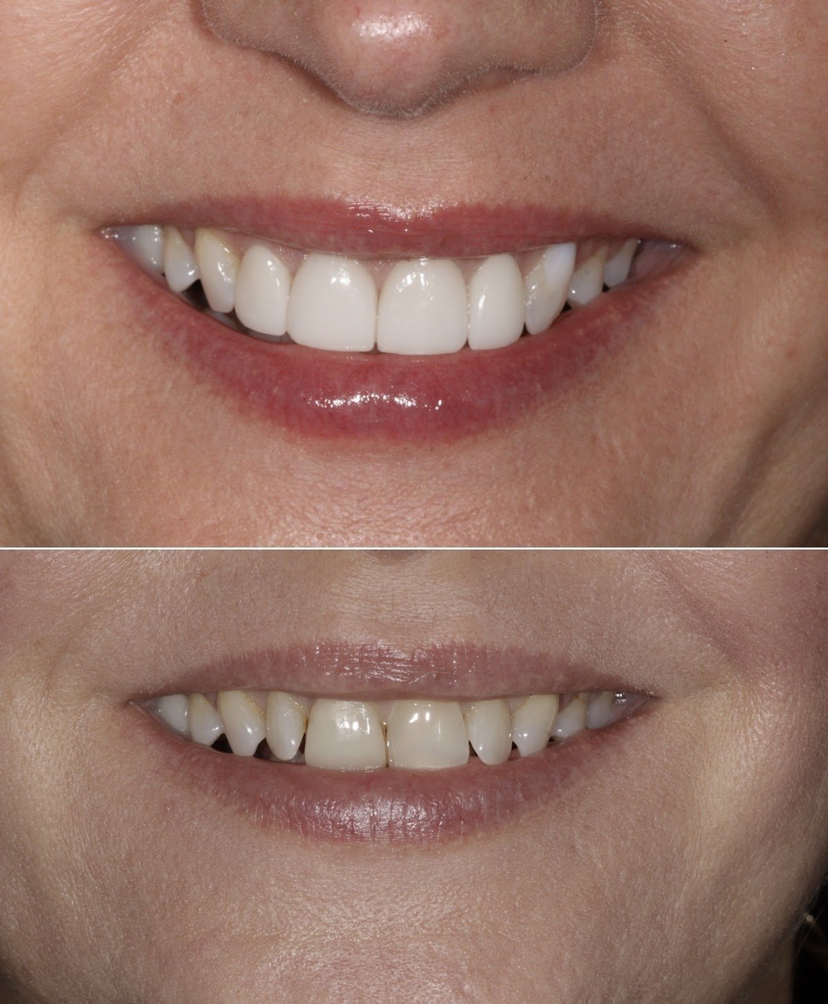 Cosmetic Dentistry of San Antonio photo 2