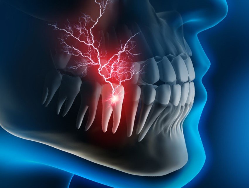 Dental Emergency Associates photo 5