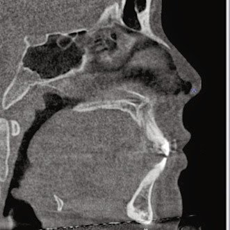 Risto E. Hurme, D.D.S. photo 2