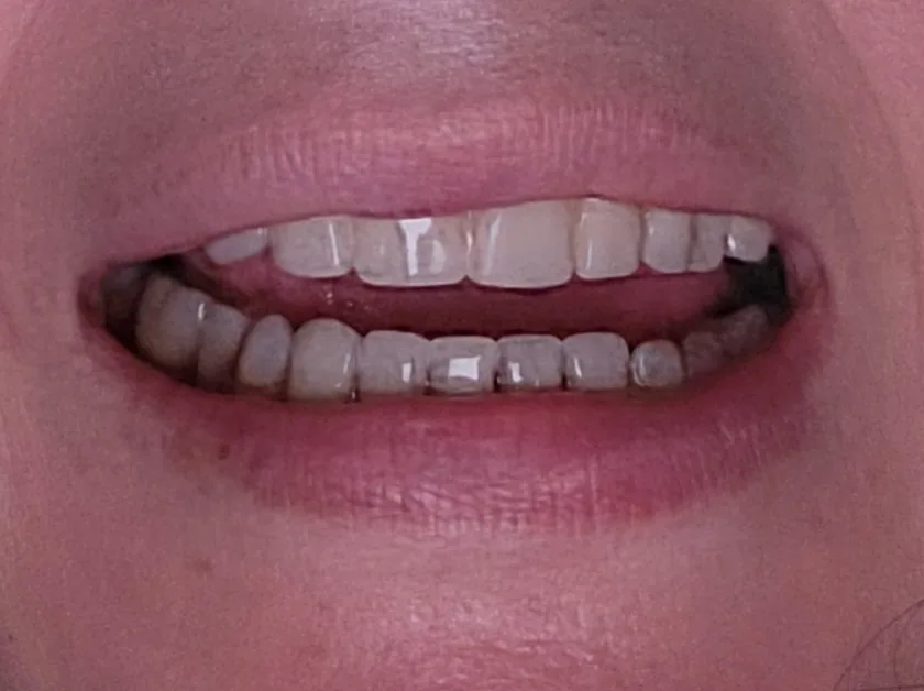 Dental Corner photo 6