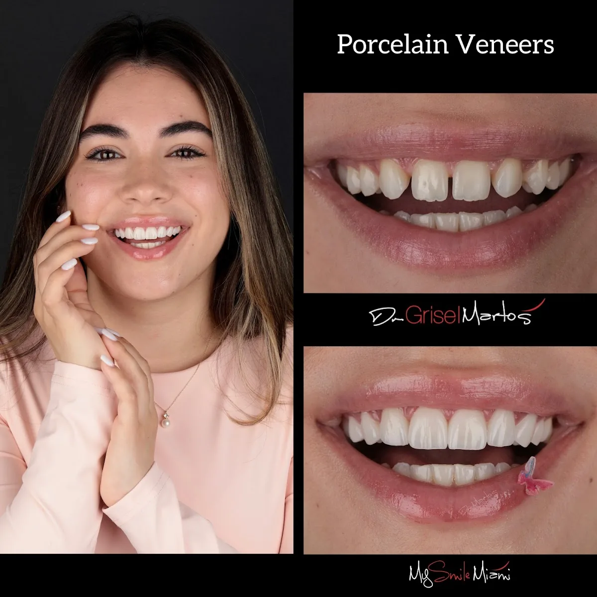 My Smile Miami photo 4