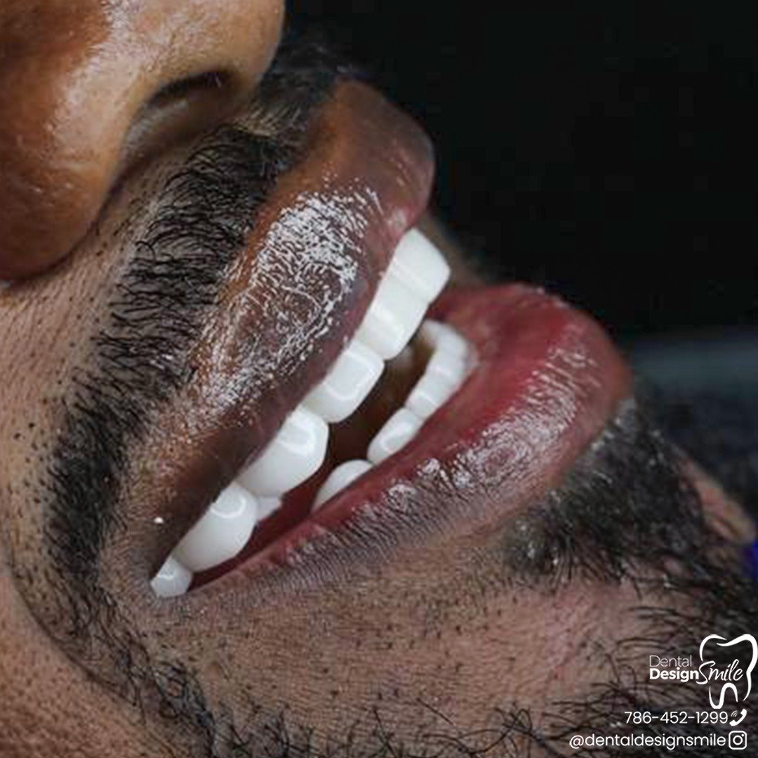 Dental Design Smile photo 1