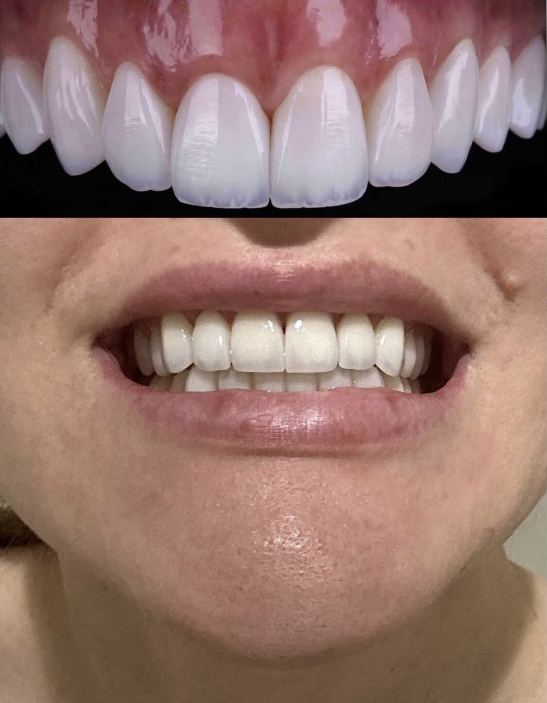 Smile Design Miami photo 2