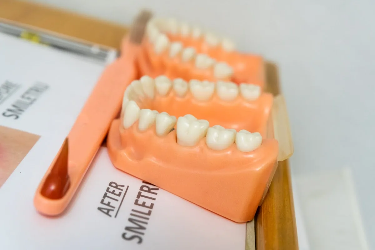 Alpine Dental photo 5
