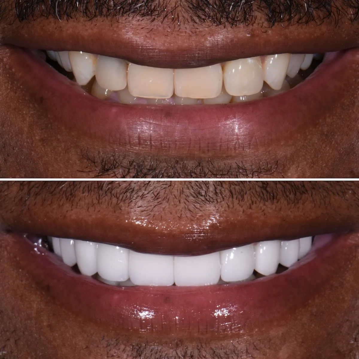 Austin Cosmetic Dentistry by Tejas Patel, DDS photo 2