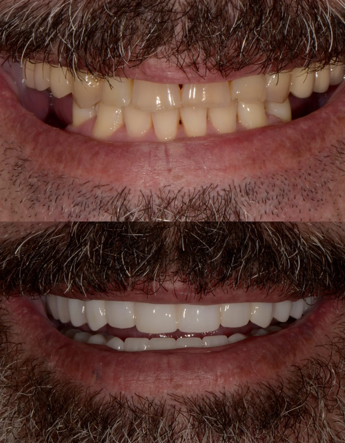 Jollyville Dental Professionals photo 2