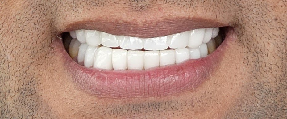 Smile Direct Club photo 2