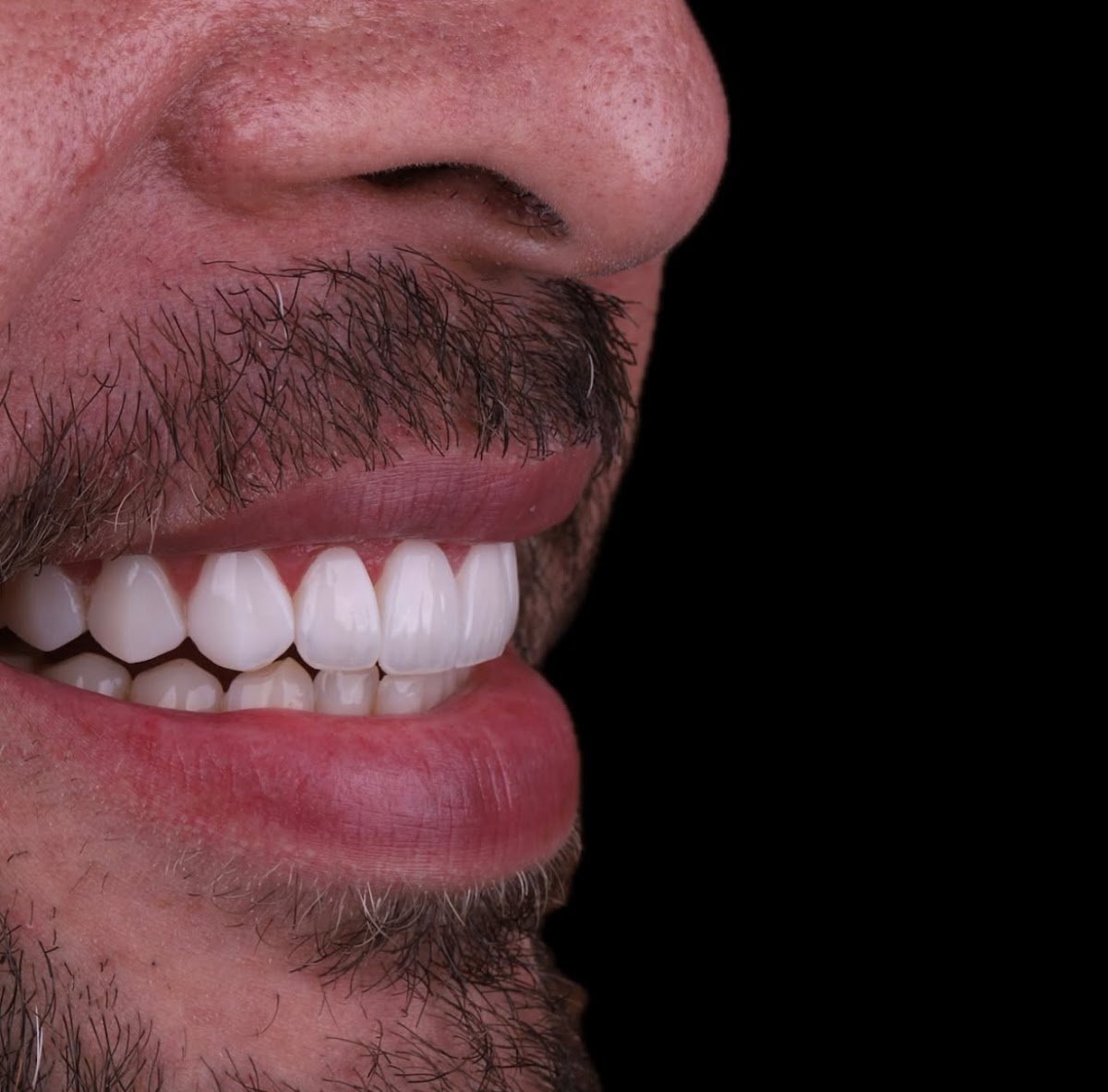 Smile Direct Club photo 5