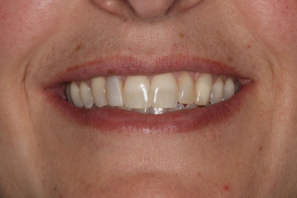 Aurora Family Dentistry photo 1