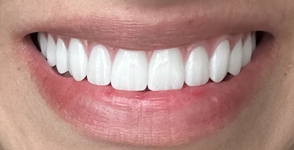 ClearChoice Dental Implant Center photo 1