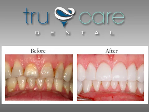 TruCare Dental photo 4
