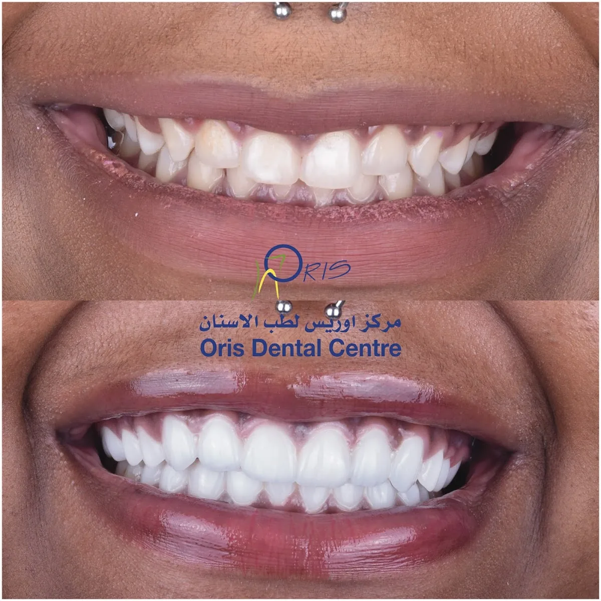 Oris Dental Centre - Jumeirah photo 3