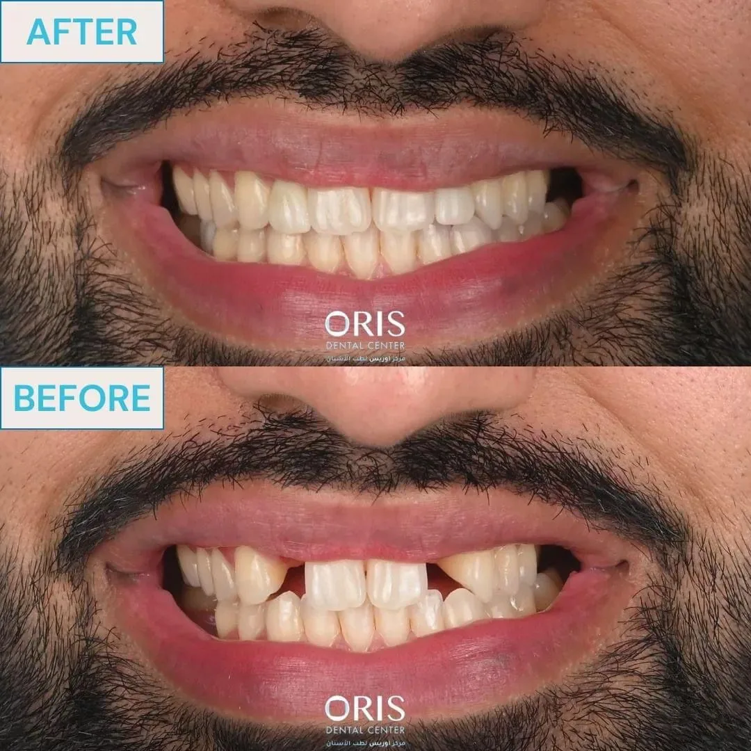 Oris Dental Centre - Mirdiff photo 4