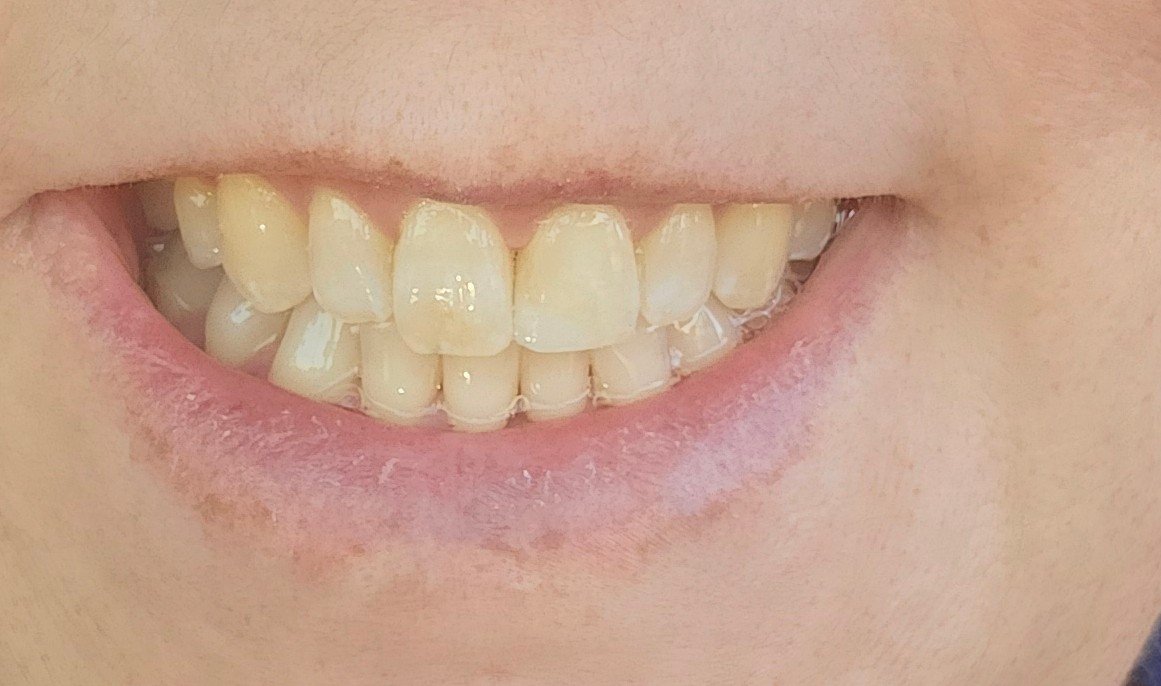 Emergency Dental Care USA photo 5