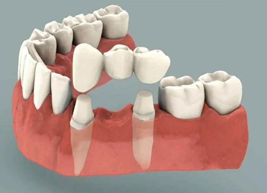 Prudential Dental Clinic, Sydney CBD photo 3