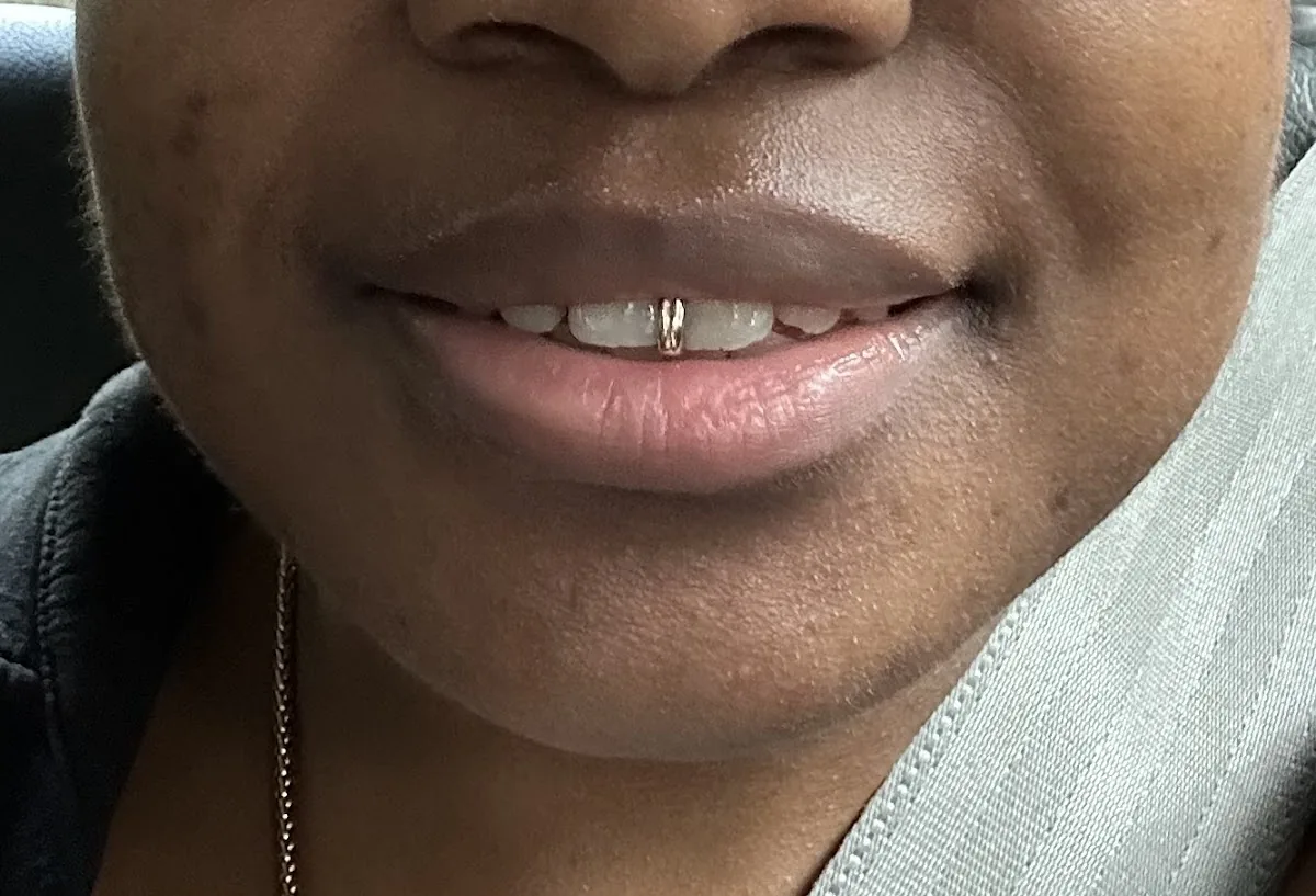 Acorn Implant &amp; Dental Practice photo 5