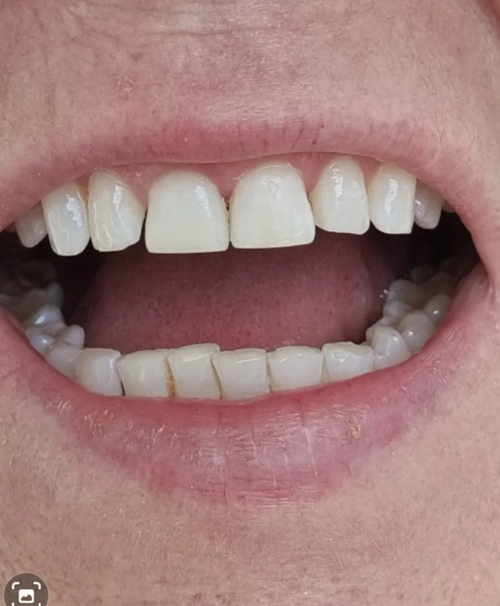 Acorn Implant &amp; Dental Practice photo 3