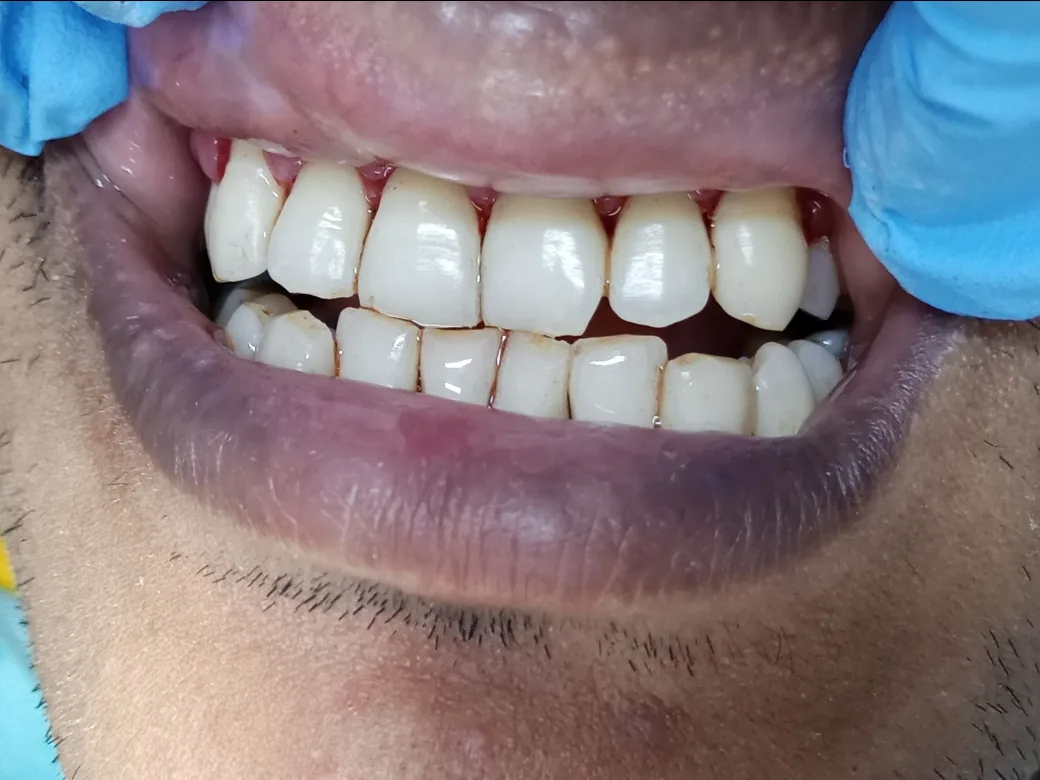 Perfect Pearls Dental Clinic photo 4