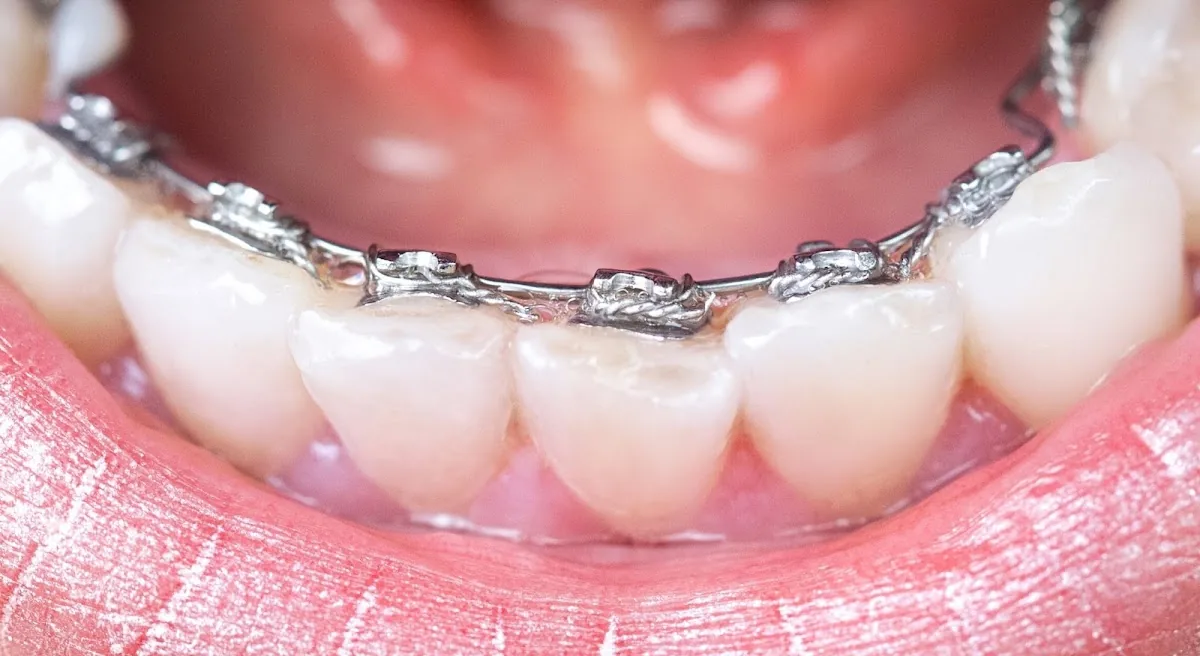 Birmingham Orthodontics photo 3