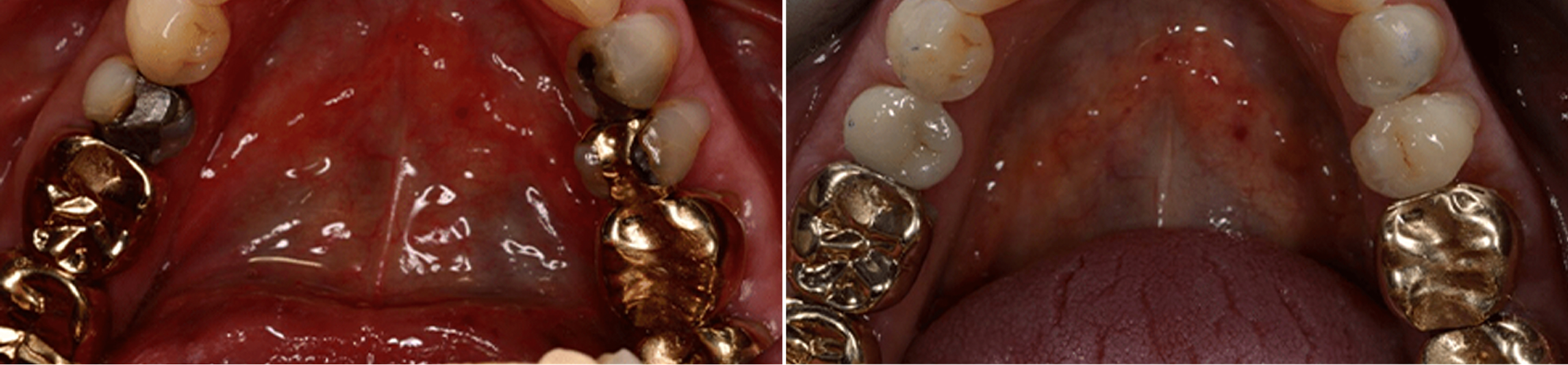 Start Smiling photo 1