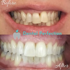 Dental Perfection photo 1