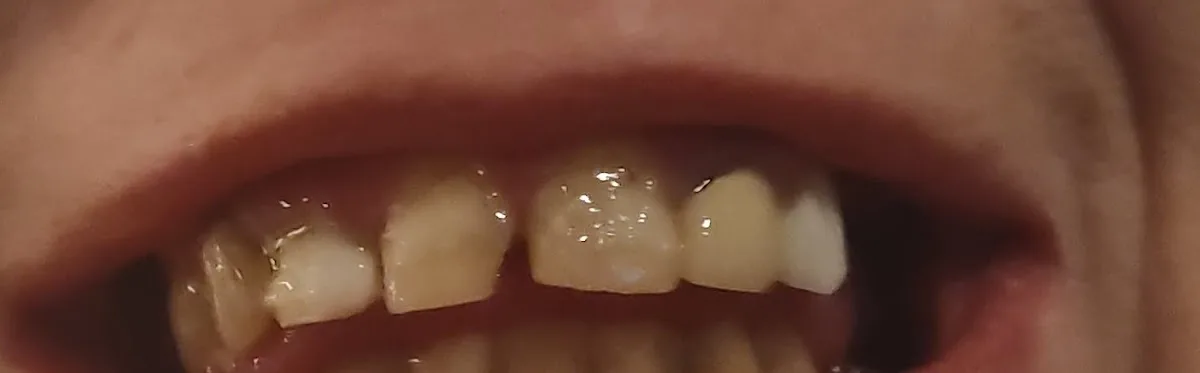 Dental Health at Midtown Denver photo 3