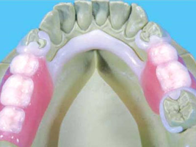 Denture Solutions at our Carlisle Lab photo 1