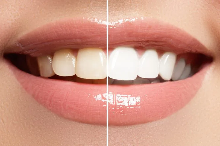 Chester Cosmetic Dental Centre photo 2