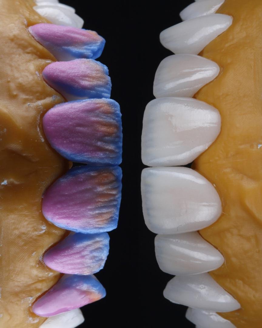 Floss in La Jolla photo 4