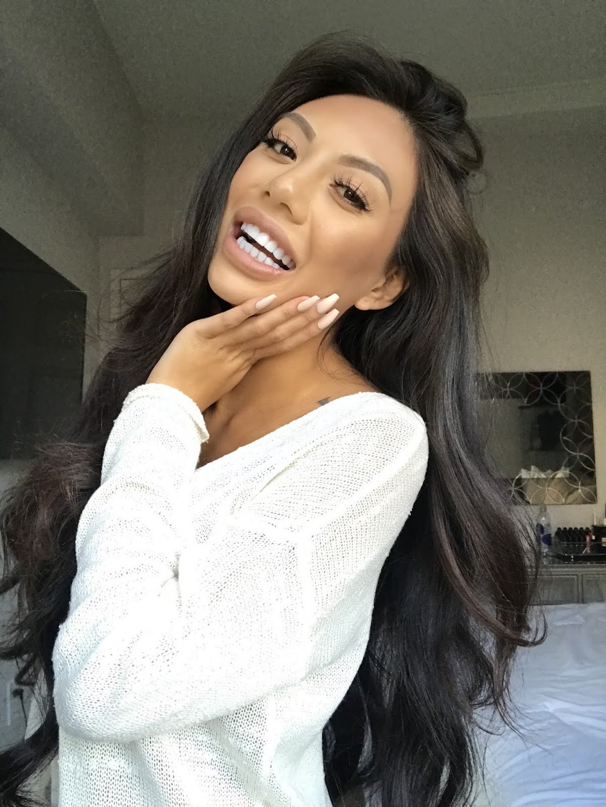 San Diego Smile Dentistry photo 4