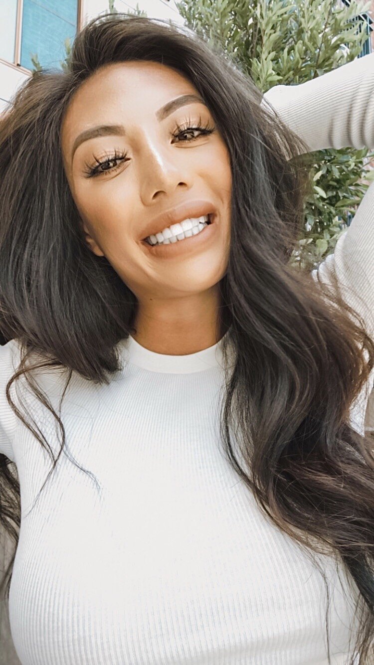 San Diego Smile Dentistry photo 5