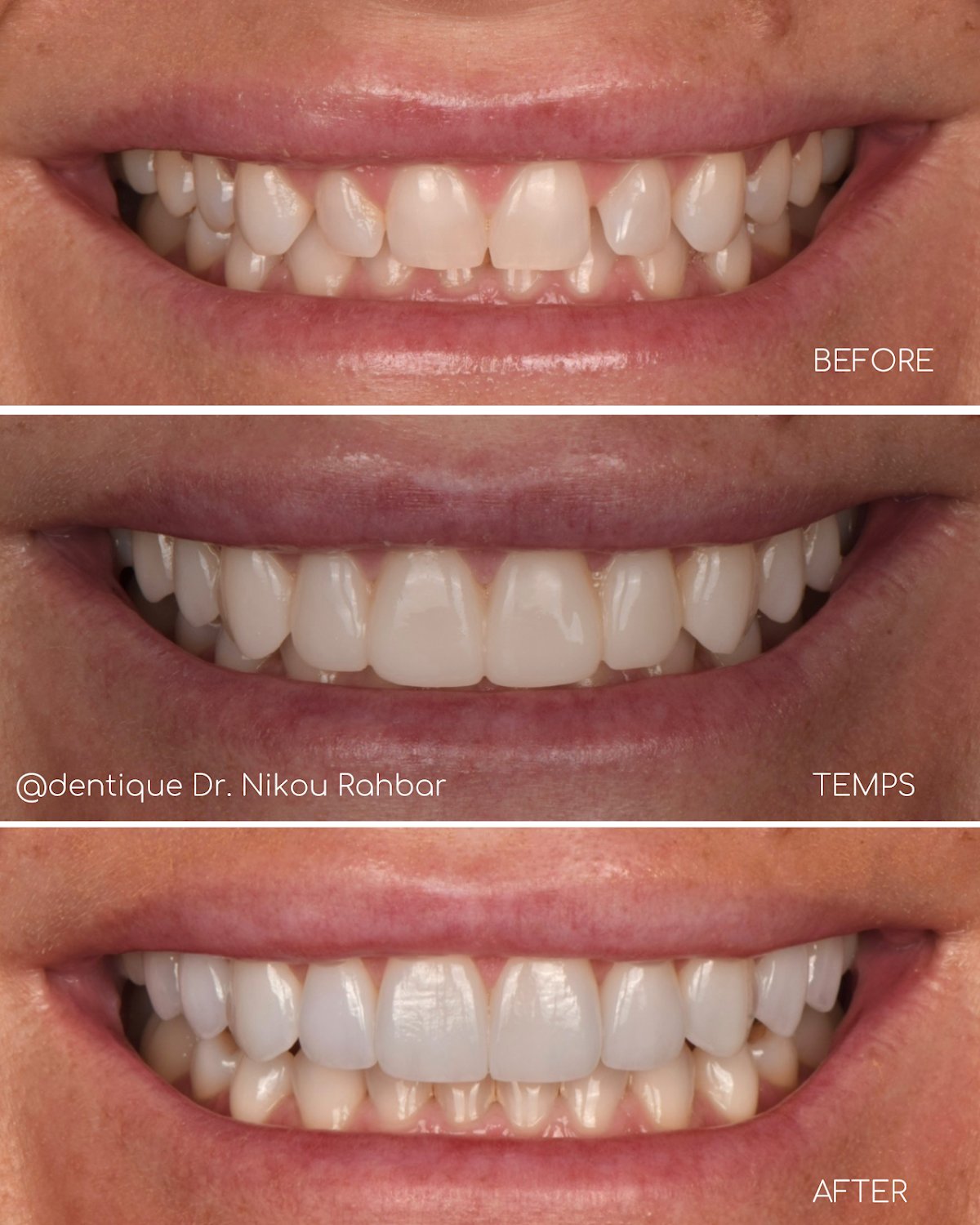 Dentique San Diego, Nikou Rahbar DDS photo 2