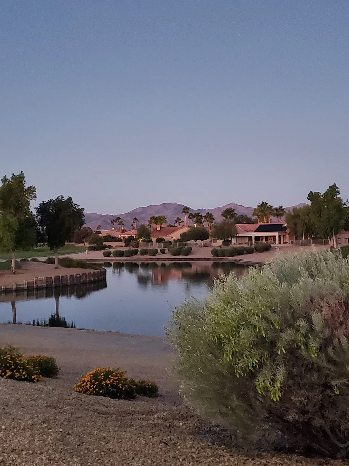 Top 10 Dental Implants in Surprise Arizona