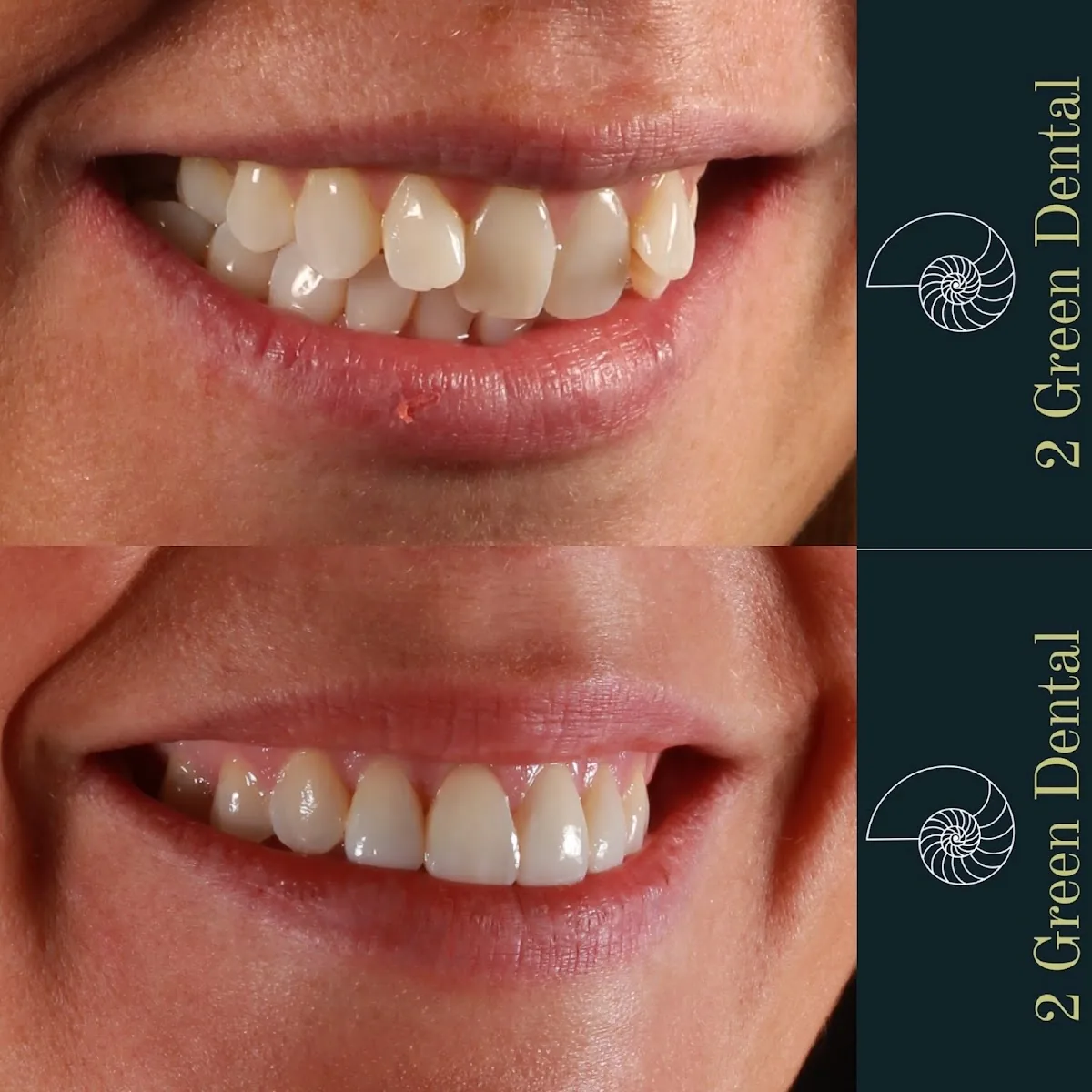 2 Green Dental photo 3
