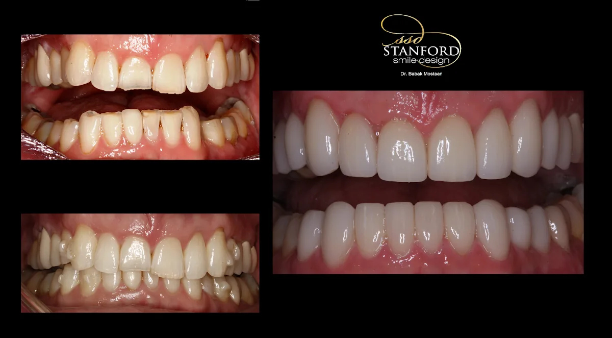 Stanford Smile Design photo 3