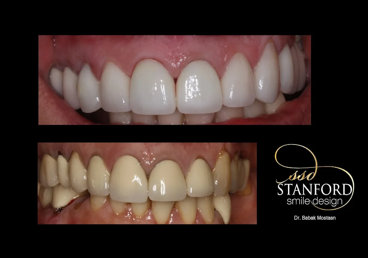 Stanford Smile Design photo 4