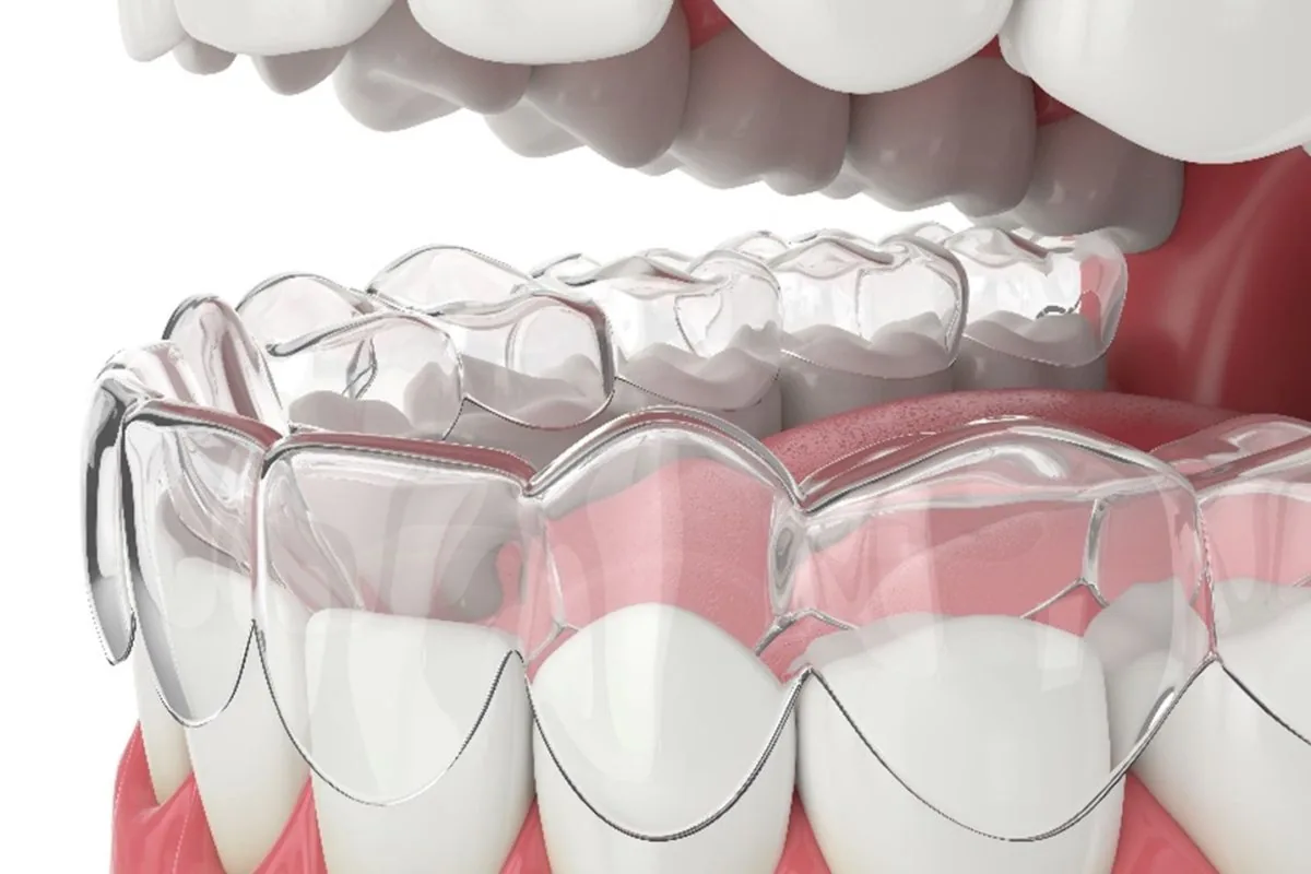 Newport Beach Dental Associates photo 3