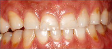 Perledent Dental Care