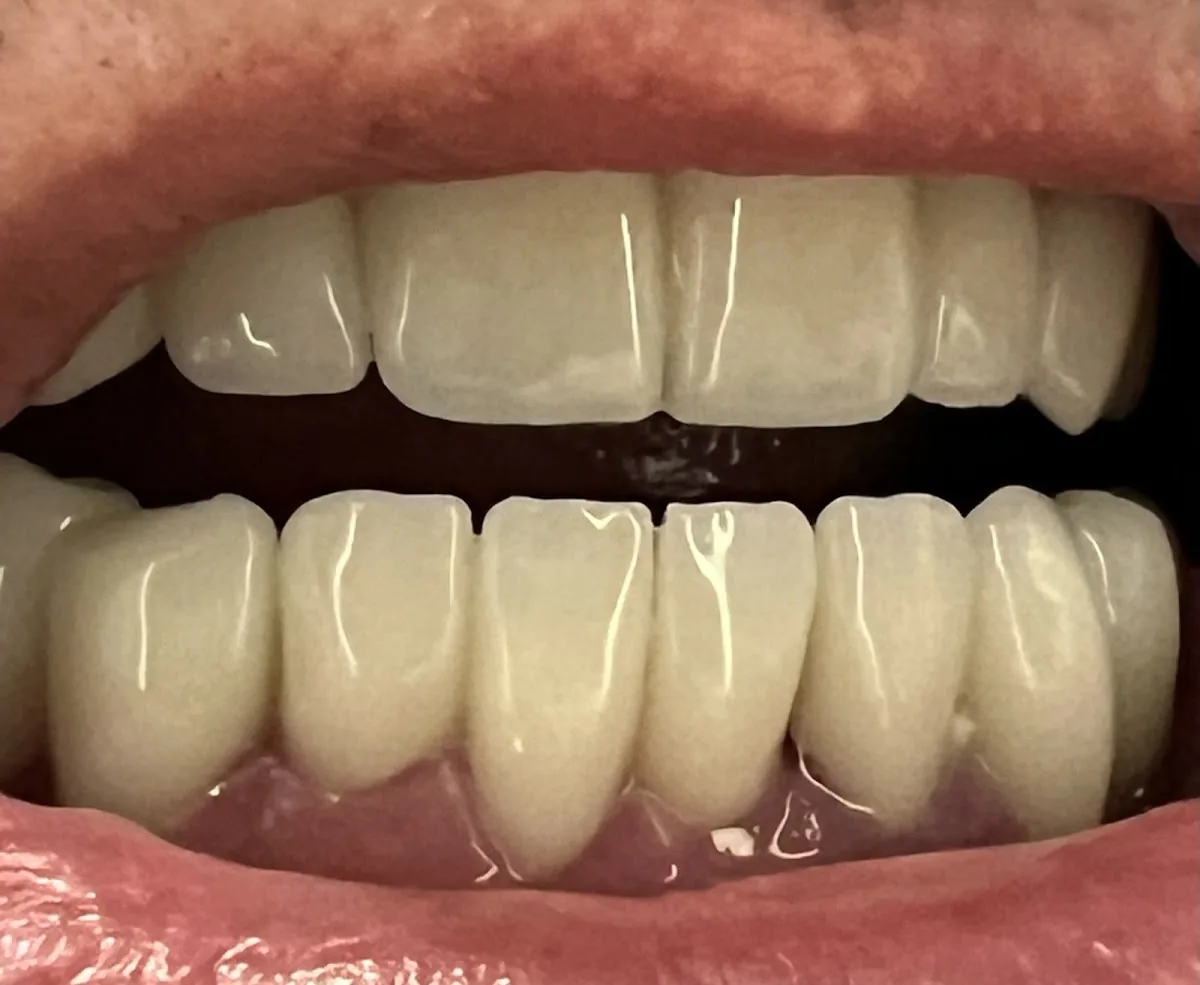 Bloomington Dental Group