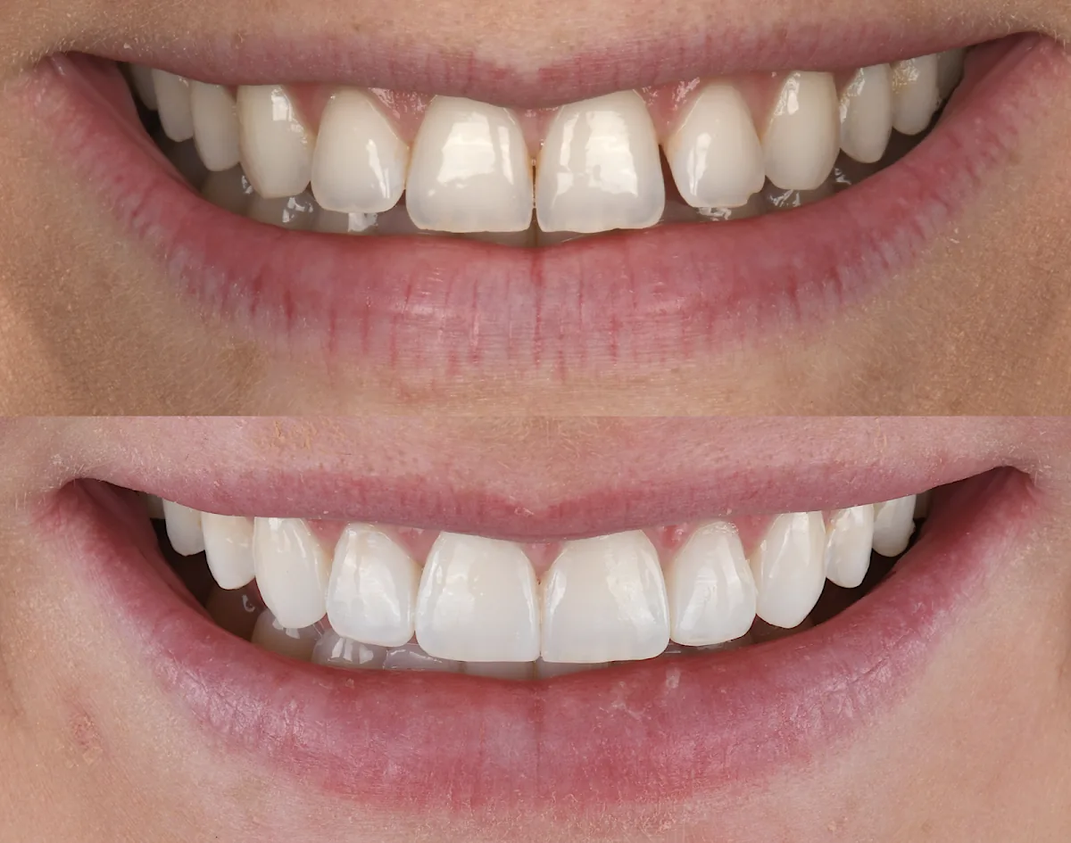 Advanced Dentistry @ Hyndland Dental Clinic photo 2