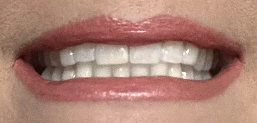 West Jackson Family Dental -Dr. Melina Gable photo 3