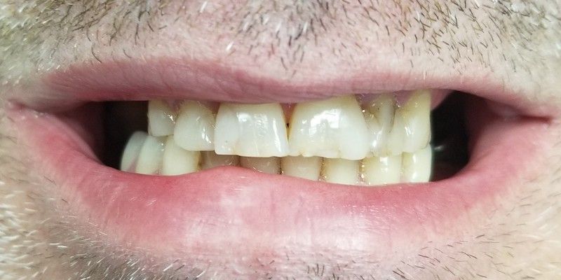 Rogue Valley Dental Center