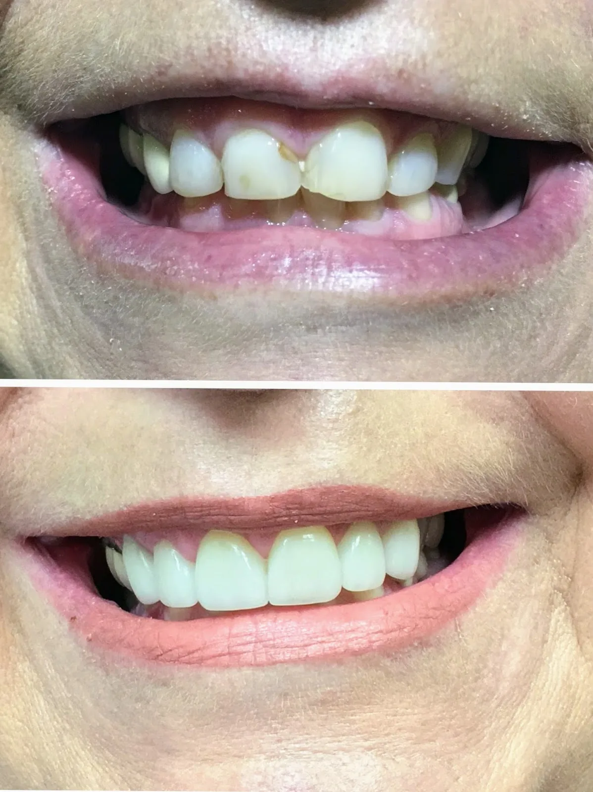 One Stop Dental - Dr. Seth Kimmelman, DDS, PC photo 3