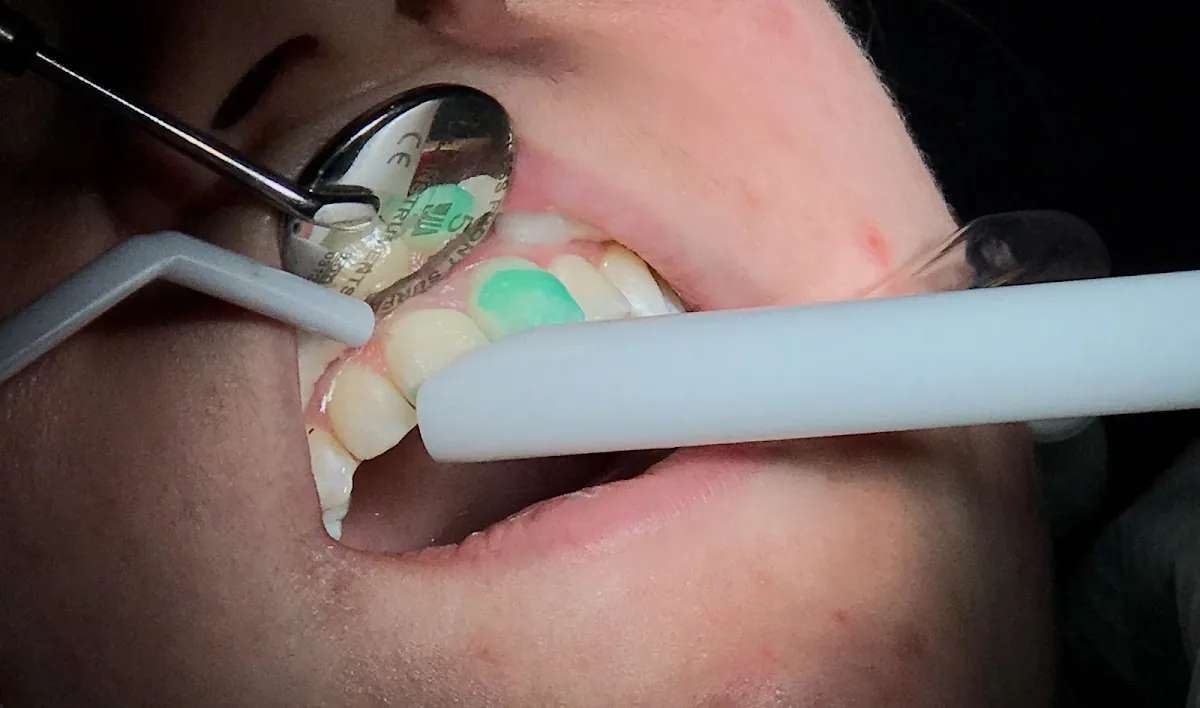 Boulevard Dental Associates photo 2