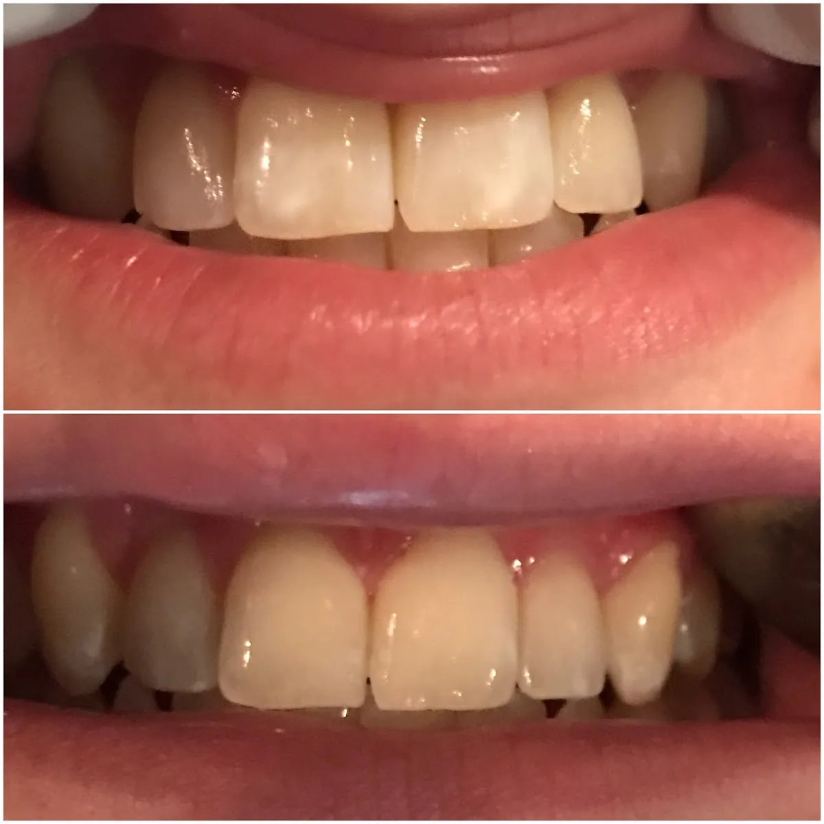 Boulevard Dental Associates photo 3