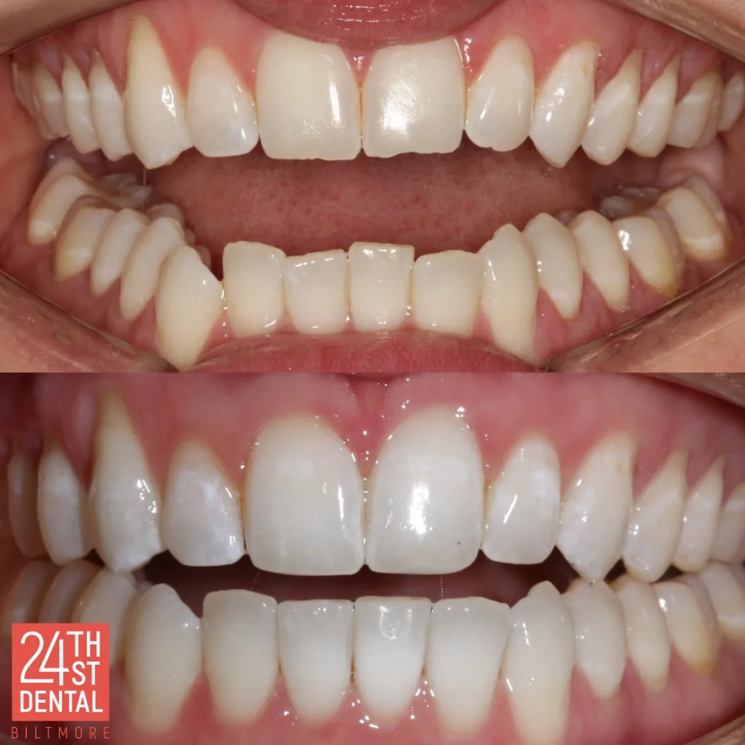 24th Street Dental Biltmore photo 3